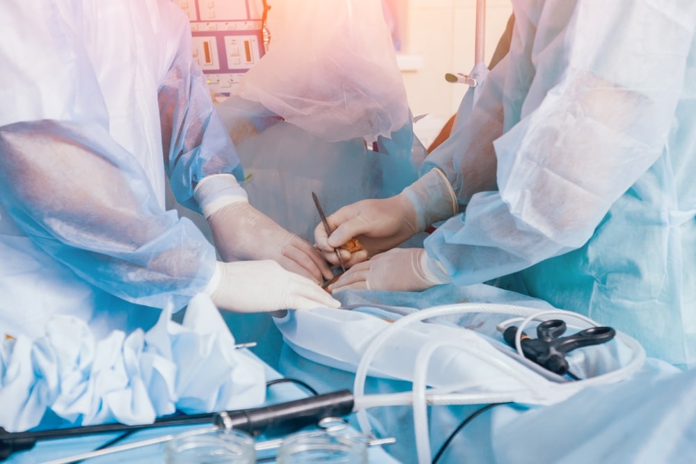 laparoskopik-ameliyatlar